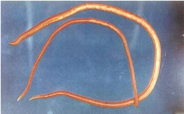 Bağırsak Kıl Kurdu Belirtileri ve Tedavisi